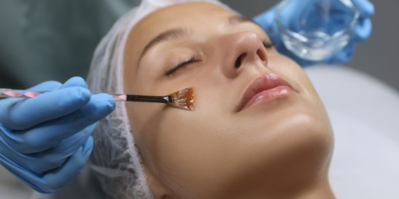 Chemical Peels Certification