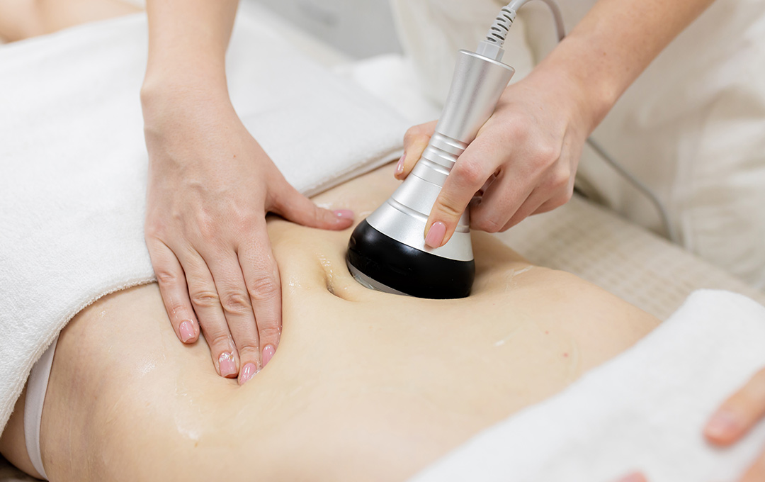 Radio Frequency body contouring