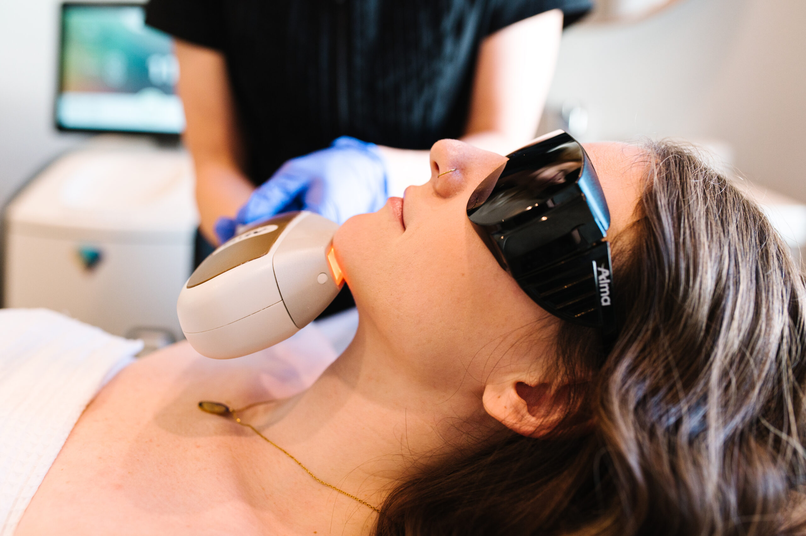 Laser Hair Removal – Chin & Jaw